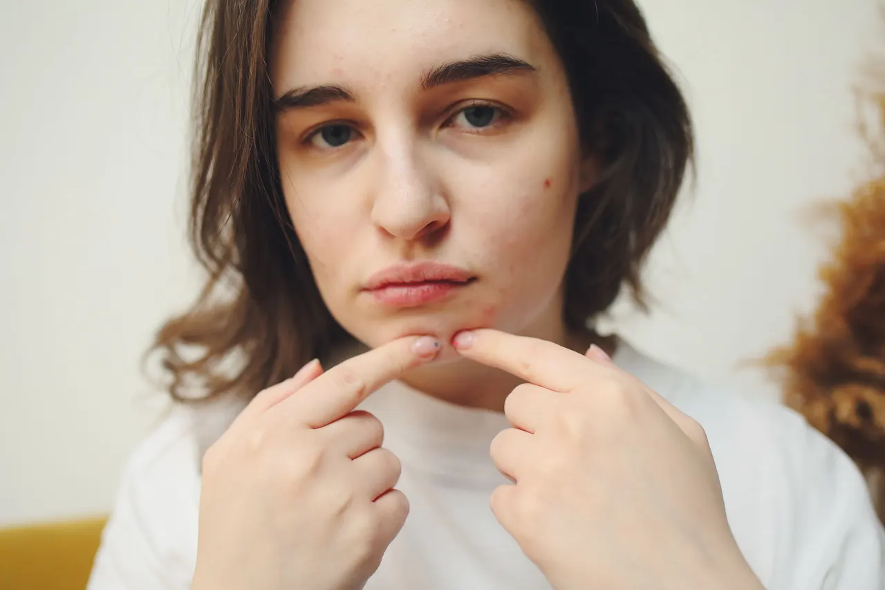 Line illustration linking a hormone signal to a skin pore