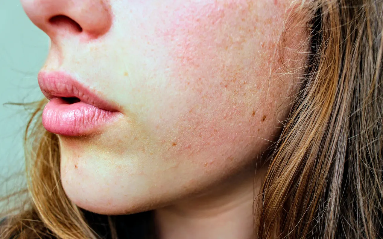 Line illustration of skin layers showing pigment cells and sunlight